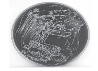 Escherichia coli on EMB agar.