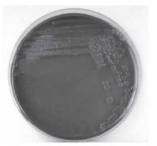Enterobacter aerogenes growing on EMB agar.