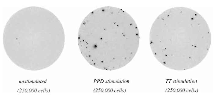 FIGURE 1 PBMC from a vaccinated donor was exposed in vitro for 16h to the antigens purified protein derivative (PPD) or tetanus toxoid (TT) and investigated for the presence of IFN-γ-producing cells.