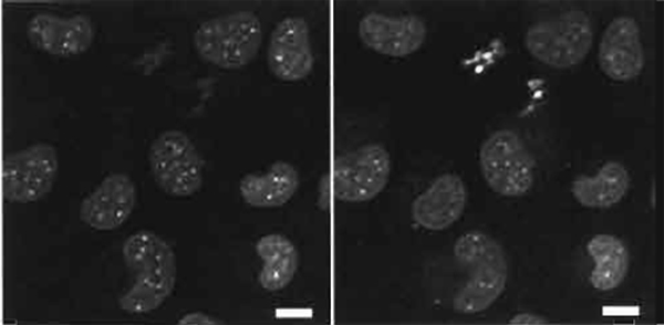 FIGURE 4 Dual images of live mouse L cells using two-photon excitation (Exλ 750nm) of nuclear-located Hoechst  33342 (5µM× 60min) showing a red-biased fluoresence emission in metaphase versus interphase cells (right side shows Emλ 585/32 nm and the left side shows Emλ 405/35 nm). Size bar: 10 µm.