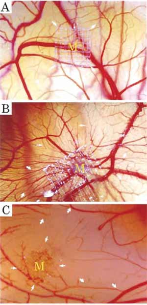 FIGURE 1 (A) Normal chick chorioallantoic membrane after 8- day incubation. (B) A typical example of the CAM stimulated by FGF-2. New vessel sprouting stimulated by 2.5 µg of FGF-2 after a 5-day implantation (arrows). (C) A typical example of inhibition of CAM angiogenesis by 50 µg of epigallocatechin-3-gallate. Formation of avascular zones is marked by arrows.