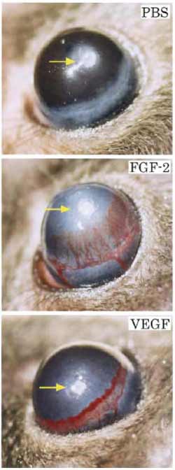 FIGURE 2 Typical examples of FGF-2-and VEGF-induced corneal neovascularization on day 5 after implantation. (Top). PBS buffer and sucralfalte polymer alone without angiogenic factors. (Center) FGF-2 at a 80-ng dose induces intense neovascularization originating from the limbal vessels toward the implanted pellet. (Bottom) VEGF at a 160-ng dose induces a robust neovascularization response.