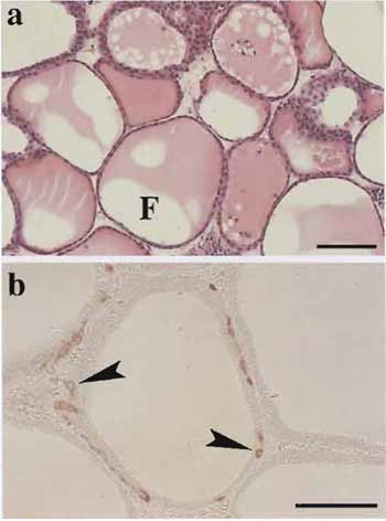 FIGURE 2 Histology of thyroid tissues (a) and immunohistochemistry for calcitonin (b) in the organotypic culture. (a) At 40 days in culture, viable thyroid follicles enclosed by thyrocytes contain colloid substance in their lumens (F). (b) At 30 days in culture, thyroid follicles consisting of both thyrocytes and C cells (arrowheads) are clearly maintained. Scale bar: 100µm.