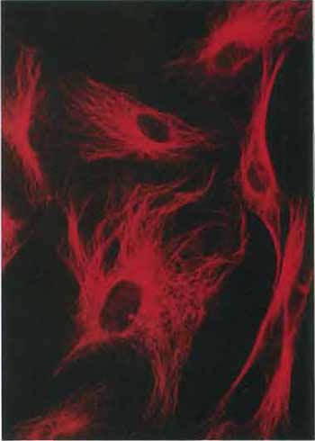 FIGURE 2 Microtubules in cells in culture revealed by staining with antibodies to tubulin followed by a rhodamine-labeled second antibody (×400).