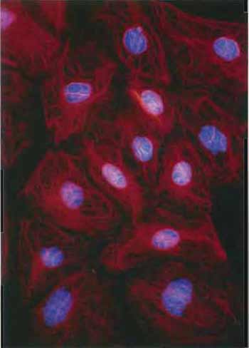 FIGURE 3 Keratin filaments in the rat kangaroo PtK2 cell line revealed by staining with antibodies to keratin and a rhodaminelabeled second antibody. DNA has been counterstained with Hoechst dye (×150).