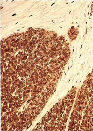 FIGURE 5 Paraffin section of human uterus stained with antibody after microwave fixation with the desmin DER 11 antibody in the peroxidase technique (×160).