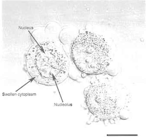 FIGURE 1 HeLa cells after step 4. Note the swollen cytoplasm and prominent nucleoli. Bar: 10 µm.