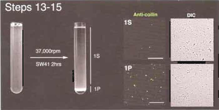 FIGURE 3 Steps 13-15 of the procedure. Note the loose pellet (1P) after centrifugation. Immunofluorescence (right) shows that most CBs are in 1P. Bar: 10µm.