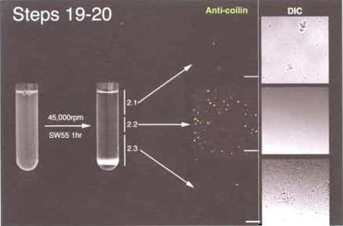 FIGURE 4 Steps 19 and 20 of the procedure. Note the thin band (2.2) in the middle of the gradient after centrifugation. Bar: 10µm.