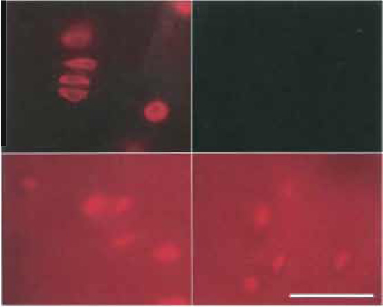 FIGURE 7 Control of background fluorescence by NaBH4. Bovine articular cartilage (100-µm-thick sections). Fixation as described in Fig. 1, but prefixation 40min and postfixation 60min. Top (left and right): Treatment with 5mg/ml NaBH4, 2 × 30min. Bottom (left and right): Control without NaBH4-treatment. Labeling: Left (top and bottom): Cy3 antivimentin; right (top and bottom): nonlabeled control. Top: exposure time 2s, bottom: exposure time 0.2s. From Baschong et al. (1999).