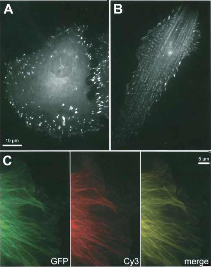 FIGURE 1 Examples for specific incorporation of fluorescently tagged, microinjected proteins: CAR fish fibroblasts microinjected with TAMRA-vinculin (A) or TAMRA-α-actinin (B). Note the specific recruitment of both probes to focal adhesions and the additional periodic incorporation of α-actinin into stress fibres. (C) EGFP-β-tubulin (kind gift of M. Geese, Braunschweig) expression (green) in a CAR cell additionally microinjected with Cy3-tubulin (kind gift of F. Severin, Dresden; red). Note that both probes reveal an identical microtubule pattern (merge) and can therefore be used equally to study microtubule dynamics.