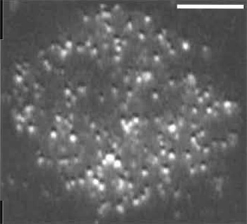 FIGURE 2 Single molecules of Lck-GFP in a T-cell
membrane. Objective-type TIRF was used to image 
Jurkat T cells that were stably transfected with a GFP 
fusion of the membrane-associated, tyrosine kinase, Lck, 
and selected for low expression levels. Scale
bar: 10µm. The bright punctae in the image correspond to
single molecules. This image was taken from a single 
frame of a sequence acquired at video rate (30 fps).