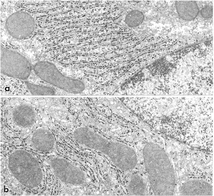 FIGURE 4 Parts of liver cells from rats perfusion fixed through the heart with 1% glutaraldehyde (a) and 4% formaldehyde plus 0.1% glutaraldehyde (b). Cell ultrastructure is similar but small focal expansions of the endoplasmic reticulum occur (b). 32,500x.