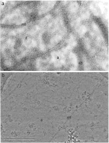 FIGURE 1 Extracted cytoskeletal networks in thin regions of cells visualised by (a) negative staining with sodium silicotungstate and (b) cryoelectron microscopy, a, actin; ab, actin bundle; mt, microtubule; if, intermediate filaments; r, ribosome aggregation. Bar: 500nm.