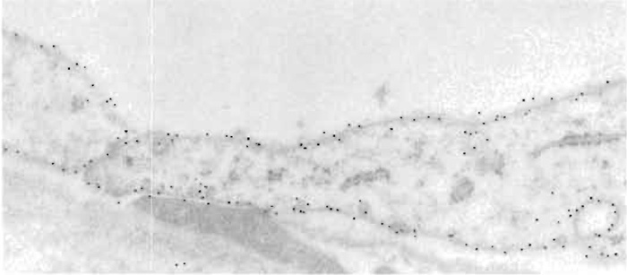 FIGURE 4 Cells in descending thin limb of inner medulla of human kidney labeled with polyclonal antibody against aquaporin-1 water channel. The tissue was fixed in paraformaldehyde and freeze substituted and embedded in Lowicryl HM20. The primary antibody was visualized with goat antirabbit IgG conjugated to 10-nm colloidal gold particles. Cells exhibit strong labeling of both apical and basal plasma membranes. Magnification 60,000×. From Maunsbach et al. (1997) with permission.