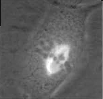 FIGURE 1 Dual-phase contrast and fluorescence image of a live PTK2 (rat kangaroo, Potorous tridactylis) cell in mitotic metaphase. The phase-dark chromosomes are aligned at the metaphase plate. Spindle microtubules contain the yellow fluorescent protein (YFP) variant of green fluorescent protein (GFP). Spindle microtubules can be seen attaching to the chromosomes and converging at each pole. See Fig. 7 for laser ablation of a microtubule bundle and transmission electron micrograph of the lesion in this cell.