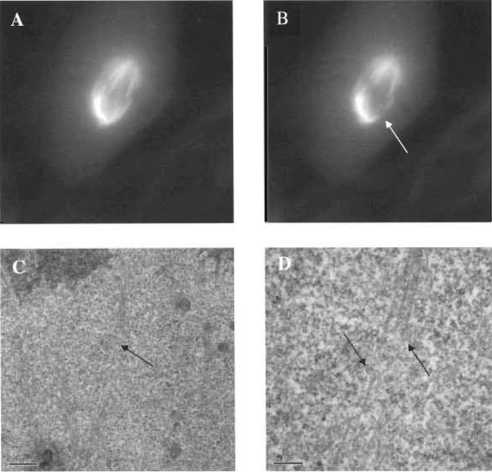 FIGURE 7 Fluorescent images of a PTK2 cell containing yellow fluorescent protein in the tubulin of metaphase microtubules. A microtubule bundle extending from the mitotic pole (centrosome region) to a single chromosome has been cut with the laser scissors, and the specific cut region has been imaged by electron microscopy. (A) Fluorescent microtubule spindle prior to laser exposure. (B) Microtubule bundle cut (arrow) using 0.5nJ/pulse of the laser scissors; total energy needed to cut the bundle was 610µJ/µm2. (C) Low-magnification transmission electron micrograph (TEM) illustrating cut zone (arrow). (D) High-magnification TEM illustrating cleanly cut microtubule in the region corresponding to the loss of fluorescence following laser exposure (see image "B"). Note that individual microtubles that have been cut/ablated continue intact on either side of the ablation zone (arrows). Scale bar: 0.2µm.