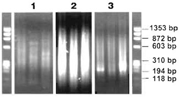 FIGURE 3 Agarose gel analysis of ligation-mediated PCR process. (1) Typical size range and DNA distribution of three MseI digest reactions. (2) Three ligation-mediated PCR products. (3) Three Re-PCR reactions. All samples were run on a conventional 1% agarose gel containing 0.5µg/µl ethidium bromide together with a φ X174 RF DNA/HaeIII DNA marker, which has a size range from 72 to 1353 bp.