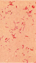 Curved, spiral, gram-negative bacilli (Campylobacter jejuni) in a Gram stain from culture. Some bacteria line up to form spirilla like chains. 