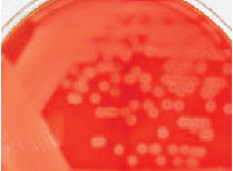 Streptococcus pyogenes growing on a blood agar plate. The clear beta-hemolytic areas surrounding the punctate colonies are caused by a streptolysin enzyme.