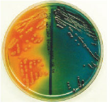 Escherichia coli (left) and Salmonella sp. (right) on a Hektoen enteric agar plate. The lactosefermenting E. coli colonies appear yellow, whereas the Salmonella colonies appear black because of hydrogen sulfide production. Compare with reactions on colorplate 16 and note how selective and differential media display different organism characteristics.