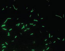 Fluorescent antibody preparation of Legionella pneumophila viewed microscopically with an ultraviolet light source. After the patient specimen is treated with an antibody conjugated with a fluorescent dye, the brightly fluorescing bacilli are easily visible against the dark background.