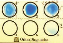 Latex agglutination reaction. Antibody-coated latex particles have been mixed with the positive (well 1) and negative (well 2) controls and the organism isolated from the patient (well 3). The dark blue rims of the positive control and patient mixtures represent the positive reaction of agglutinated latex particles. Well 6 is an additional control.