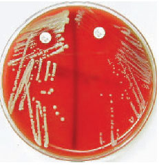 Novobiocin disk test for differentiating two coagulase-negative species of staphylococci: Staphylococcus saprophyticus (left) and Staphylococcus epidermidis (right). The zone of inhibition around S. saprophyticus is less than 16 mm, which identifies this species by its resistance to the antibiotic.