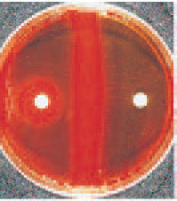 Bacitracin test. The organism on the left is identified presumptively as Streptococcus pyogenes (group A), because it shows a zone of growth inhibition around the bacitracin disk. The bacitracin-resistant organism on the right is a betahemolytic streptococcus other than group A.
