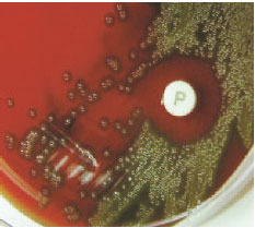 Optochin test. A zone of inhibition forming around a disk containing optochin (P disk) identifies this organism presumptively as Streptococcus pneumoniae.