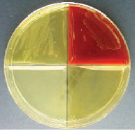 Haemophilus ID Quad Plate inoculated with Haemophilus influenzae. The organism grows only on the top two quadrants, which contain media supplemented with X and V factors (left) and 5% blood and V factor (right).