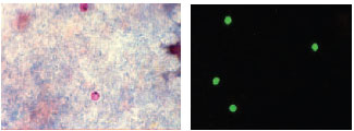 Cryptosporidium spp. are prevalent in animals but also infect humans, causing massive, watery diarrhea. Diagnosis can be made by finding oocysts in the patient’s fecal specimen, either with a modified acid-fast stain (circular red objects, left) or with a specific fluorescent antibody reagent (circular green objects, right).