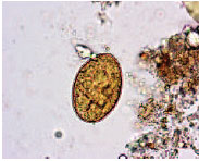 Characteristic egg of the fish tapeworm, Diphyllobothrium latum, ×400. Larvae in raw or undercooked fish mature to adulthood in the human intestinal tract and shed eggs that help provide the diagnosis.