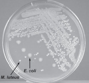 e coli streak plate