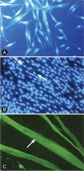 Human Skeletal Myocytes