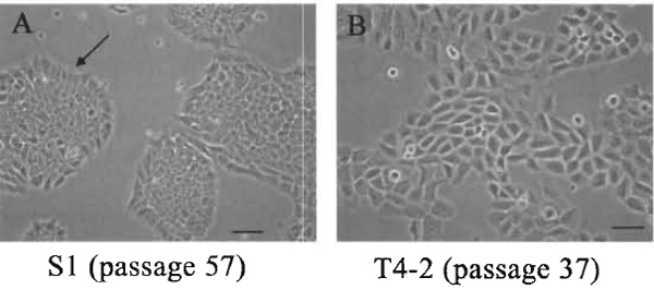 FIGURE 1 The morphology of S1 and T4-2 cultured on tissue culture plastic. (A) S1 cells, passage 57, at day 10 after plating. The colonies are essentially round with smooth edges and with the inner cells somewhat compacted. Cells at the edge should take on a polar-like appearance indicated by the arrows. (B) T4-2, passage 37, at day 5 after plating. Cells are larger than $1, the colonies are irregular, and cells at the edges rarely show any organization. Bar: 25 µm.