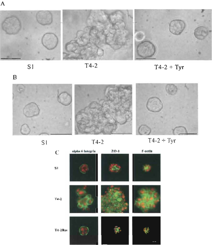 FIGURE 4 Morphological and immunofluorescence analyses of S1, T4-2, and T4-2 treated with LY 294002 or tyrphostin AG1478. (A) Cells were embedded in Matrigel and cultured for 10 days. (B) Cells were cultured for 4 days on top of Matrigel. S1, T4-2, and T4-2Rev cells were treated with 0.1 mM AG1478 tyrphostin. Photographs were taken using a phase-contrast microscope. A & B Bars: 25 mm. (C) Structures isolated from 3D BM after 10 days in culture were stained with the basal marker α6- integrin, the apical marker ZO-1, and the cytoplasmic marker F-actin. S1, T4-2, and T4-2Rev cells were treated with 10mM LY 294002. Photographs were taken using a fluorescence microscope. Bars: 10mm.
