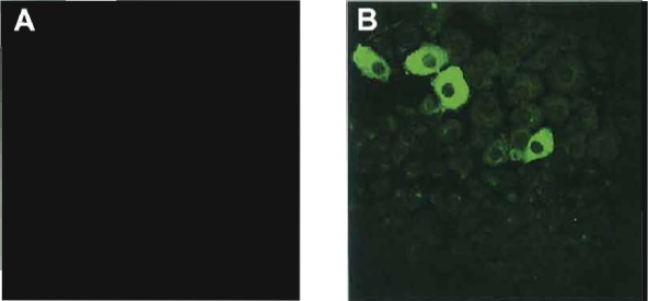 FIGURE 1 Immunostaining for albumin in control (A) and dexamethasone-treated AR42J-B13 cells (B).