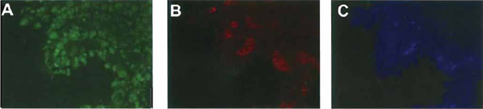 FIGURE 2 Immunostaining for amylase, insulin, and glucagon in normal pancreatic buds. Pancreatic buds were cultured for 7 days and then immunostained for amylase (A), insulin, (B), and glucagon (C).