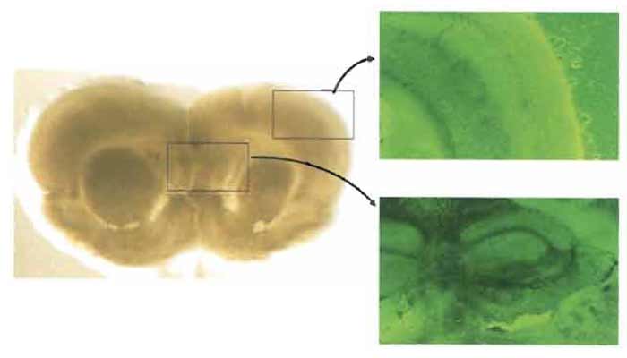 FIGURE 2 Morphological pictures of a rat brain slice after 8 days of culture. Normal cytoarchitecture, including cortical lamination and hippocampal structure, is clearly observed (left: macroscopic picture, ×0.5; right: phase contrast, ×40).