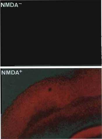 FIGURE 3 Neuronal viability of rat brain slices assessed by cellular uptake of propidium iodide (PI) without (upper) and with (lower) treatment of N-methyl-D-aspartate (NMDA). Normally functioned neurons can exclude PI and show early or delayed neuronal cell death by NMDA insult, thus permitting entry of the PI into the cells.