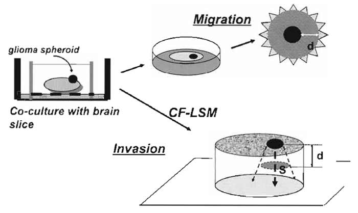 FIGURE 4 Illustrative procedures of tumor cell migration and invasion assay in cocultured brain slices. A tumor (glioma) spheroid is placed on the brain slice and is cocultured at the interface between air and culture medium. For tumor cell migration, the extent of the spread of fluorescent dye-stained tumor cells on the surface of the slice is measured. For tumor cell invasion, the spatial extent of the tumor cell infiltration in the slice is analyzed by confocal laser-scanning microscopy (CF-LSM). d, distance; S, area.