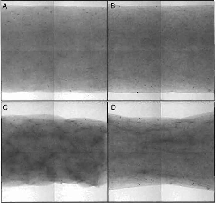 FIGURE 9 Examples of unstressed, free-floating assay (A,C) and stressed, constrained assay (B,D). Migration-traction assays are prepared as described and are nearly identical after initial preparation. (A) Free-floating cylindrical gel at time = 0. The gel was formed by supporting a sheath with smooth-ended polycarbonate posts. (B) Contstrained cylindrical gel at time = 0. The gel was prepared by filling an identical sheath that is supported by stainless-steel posts with porous polyethylene discs glued to the ends (outside field of view). The biopolymer solution penetrates the pores to form a fixed boundary condition upon gelation. Following incubation, cells that are entrapped in the gel exert traction and compact the gel. (C) Without physical constraints to compaction, the free-floating, cylindrical gel compacts (roughly) uniformly. (D) In contrast, the physical connection to the posts via the porous polyethylene prevents the constrained gel from compacting in the axial direction. The result is pure radial compaction and subsequent fiber and cell alignment. The characteristic "hourglass" shape results. In both cases, the degree of cell traction is related to the amount of gel compaction, measured as the decrease in radius at the midplane of the sample.
