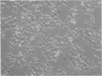 FIGURE 3 Phase-contrast photograph of 293T cells. 293T/17 cells are seeded the day before transfection at 1 to 3 million per 10-cm culture dish. At the time of transfection, cells must have the morphology and density as shown here.