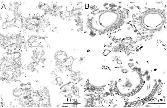 FIGURE 3 Representative micrographs of a typical rat liver Golgi preparation showing stacked membranes at low (A) and high (B) magnification. Bars: 1 µm (A) and 0.2µm (B).