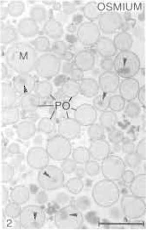 FIGURE 2 Electron microscopic appearance of isolated heavy peroxisomes after fixation in glutaraldehyde and osmium. The fraction consists almost exclusively of peroxisomes (PO) with only a rare mitochondrion (M). Many peroxisomes contain urate oxidase cores (arrowheads). Bar: 1µm.
