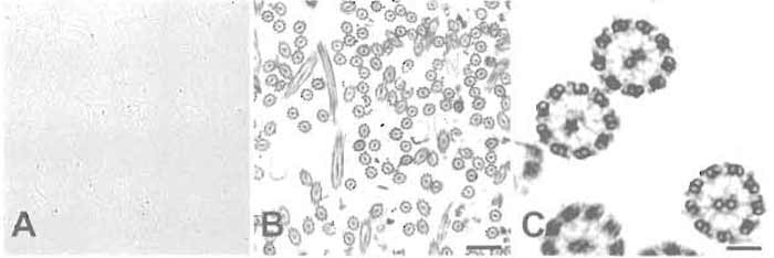 FIGURE 2 (A) Phase-contrast light micrograph of isolated cilia showing the appearance of the preparation after step 10 (original magnification, 400×). (B) Electron micrograph showing many intact ciliary axonemes after step 12. (C) Higher magnification of the same preparation as in B showing details of the isolated axonemes. Note the presence of radial spokes and dynein arms. Scale bars: 1.1 µm (B) and 0.15µm (C).