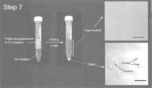 FIGURE 3 Step 7 of the procedure. Note the clear boundary between S1 and S2 layers before centrifugation. (Insets) DIC images of the supernatant and pellet. Note prominent nucleoli inside nuclei in the pellet. Bars: 10 µm.