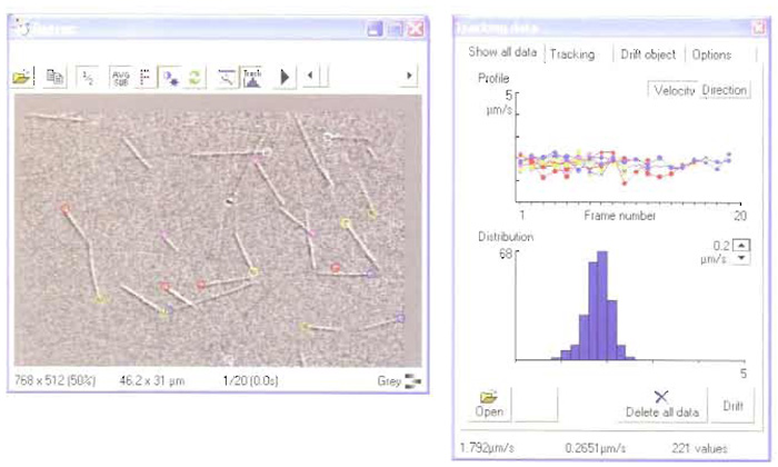 FIGURE 2 A screenshot from RETRAC 2.