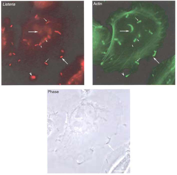 FIGURE 4 Actin polymerisation and protrusion formation by Listeria. LoVo cells were infected with Listeria as described in the text. Both bacteria and the actin cytoskeleton were labelled for immunofluorescence analysis. (Top left) Labelling of the total population of bacteria associated to LoVo cells. (Top right) Actin labelling with the fungal drug phalloidin. While some bacteria are not associated with actin (small arrowheads), other bacteria are detected at early phases of actin polymerisation (small arrows). Bacteria at later stages of their intracellular cycle can be observed at the tip of actin comet tails (big arrows). Listeria that have reached the plasma membrane can form protrusions that extend beyond the infected cell (big arrowhead). (Bottom) Phase image of LoVo cells and Listeria. Bar: 5 µm.